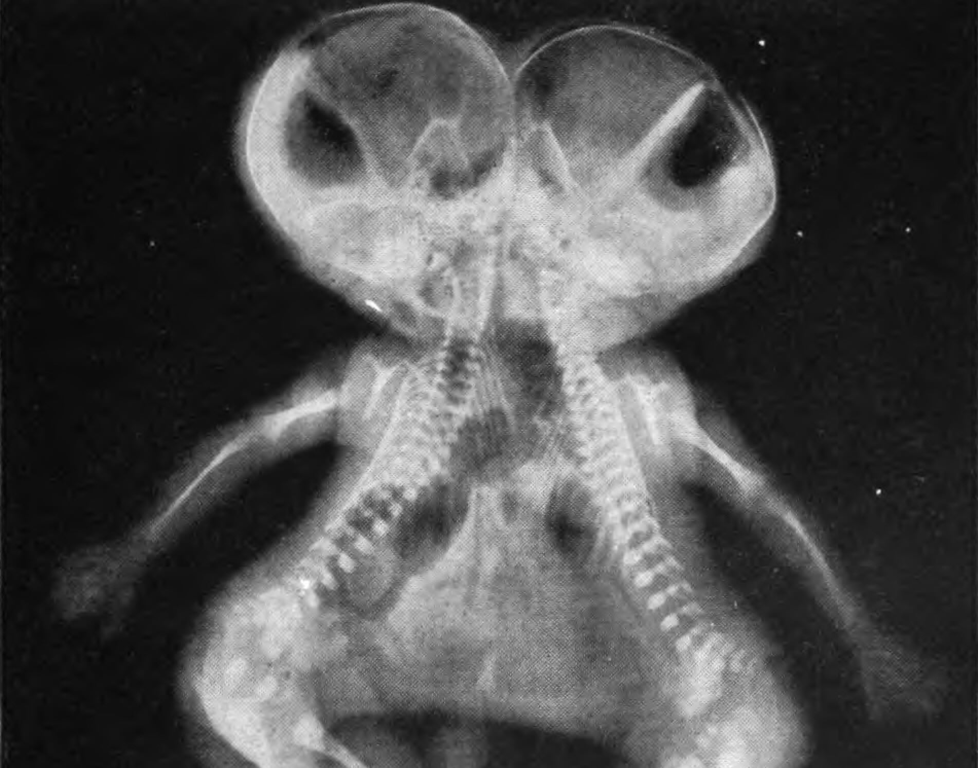 The Conjoined Boys Chamber Choir