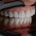 Cogs at the Dentist