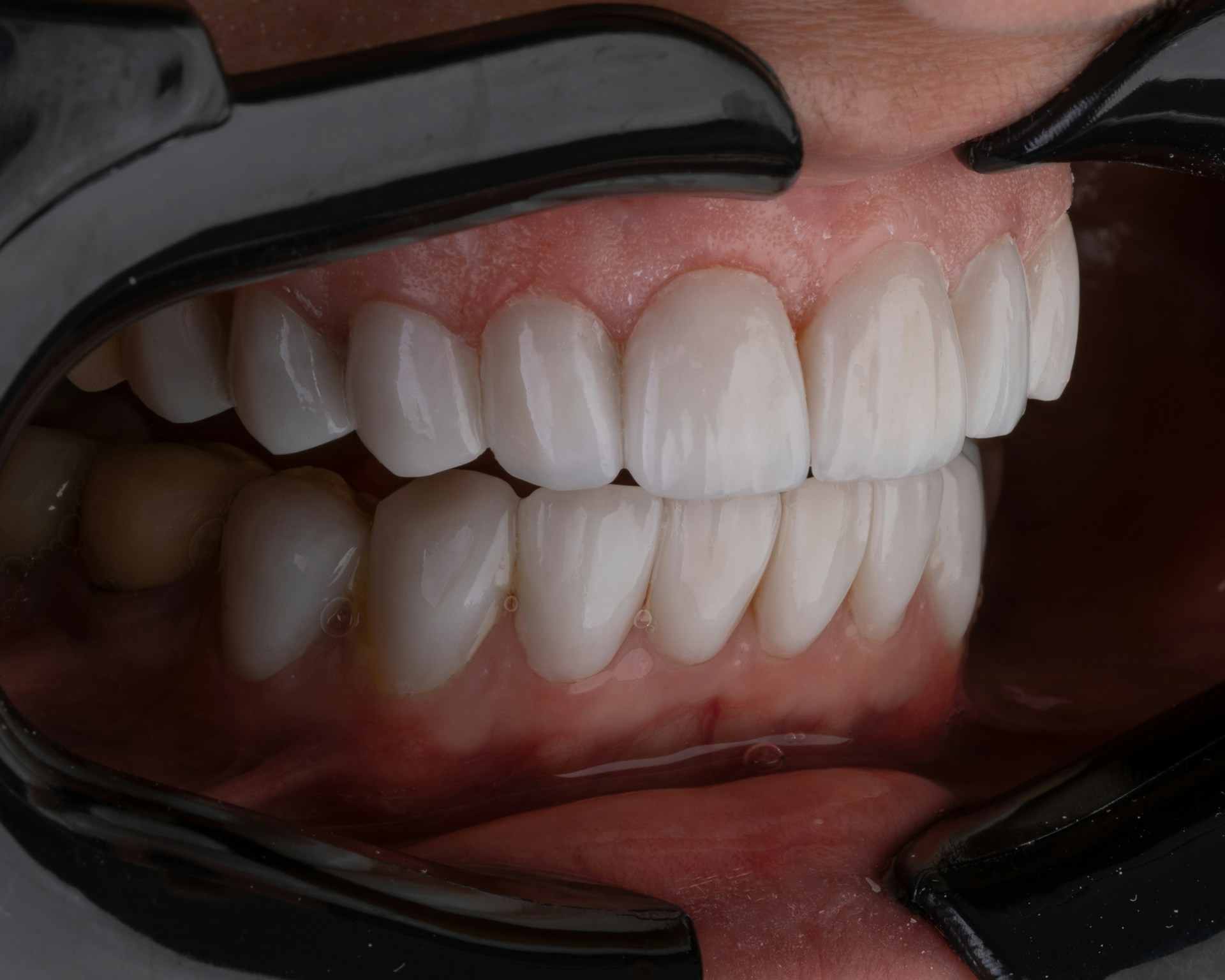 Cogs at the Dentist
